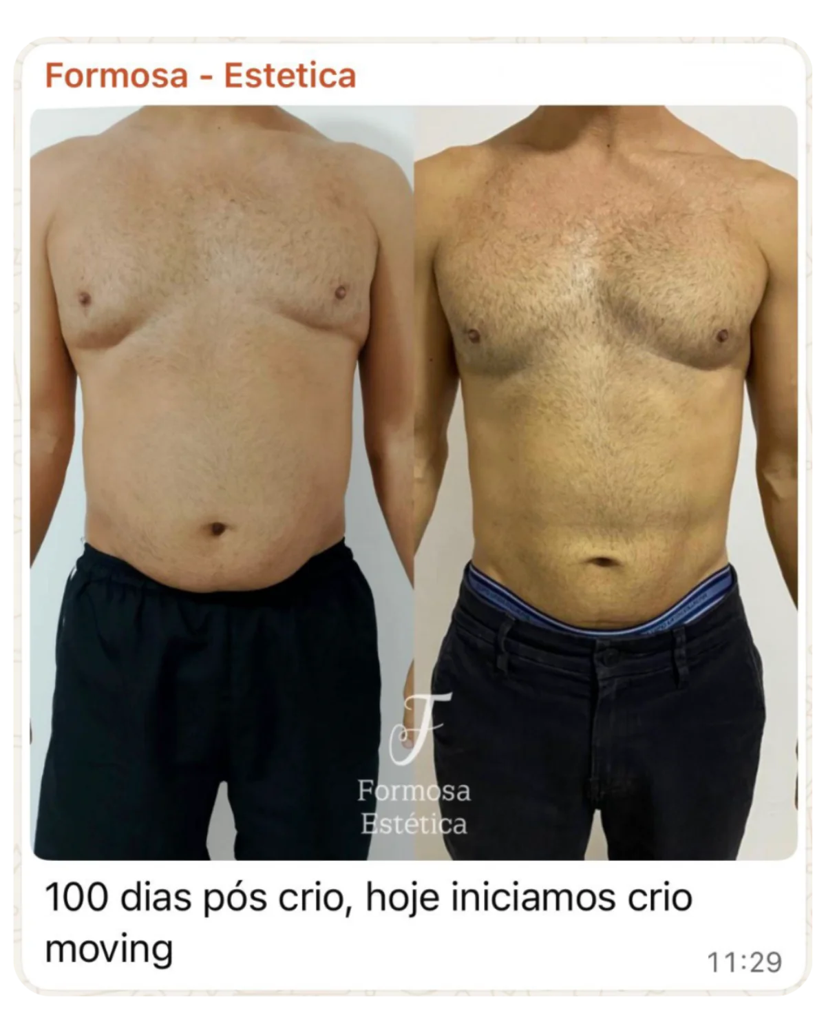Depoimento aluna CRIO LIV PRO 1